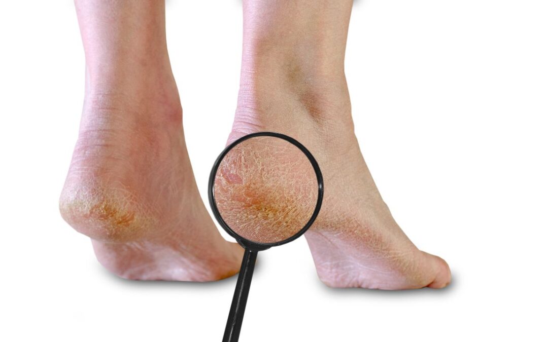 Rutina corectă de îngrijire a picioarelor acasă – ce e bine și ce trebuie evitat