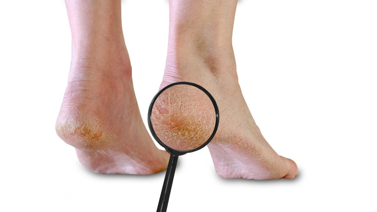 Rutina corectă de îngrijire a picioarelor acasă – ce e bine și ce trebuie evitat